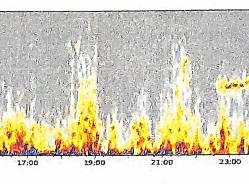 Herzratenvariabilitätsmessung